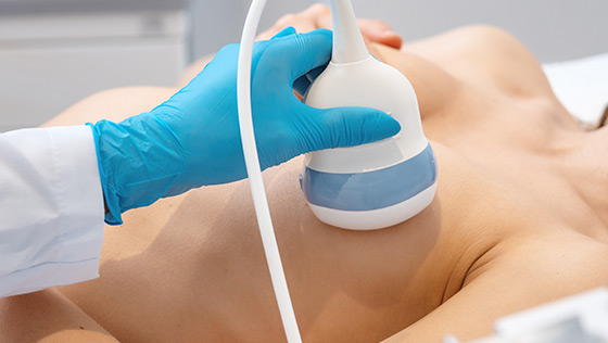 추적 관찰 및 관리